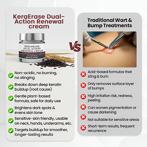 ✅Flash Sale -HEALRIZE® KeraErase Dual-Action Renewal Cream