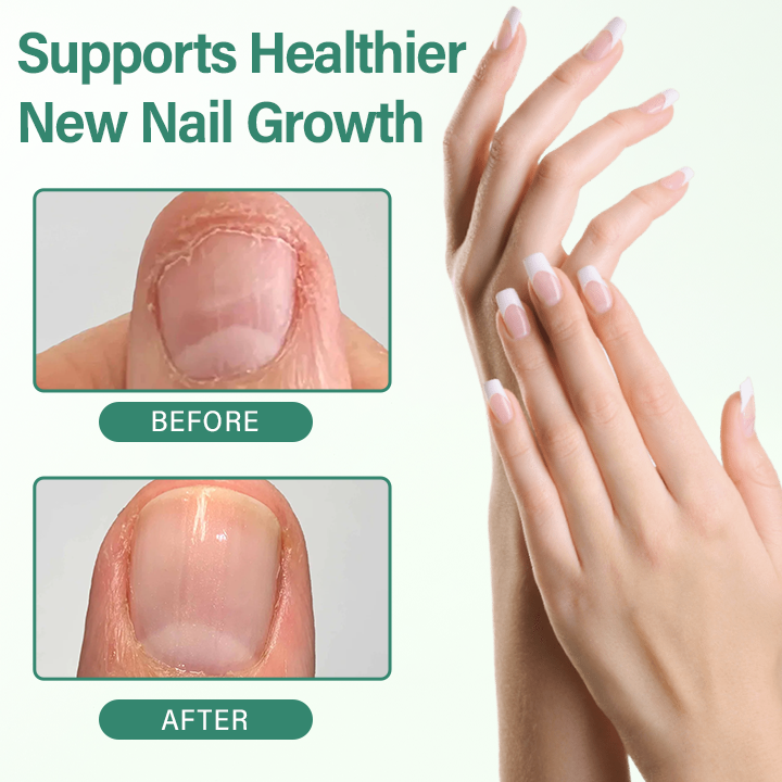 Alcuras® Nail Detox Penetration Serum Pen
