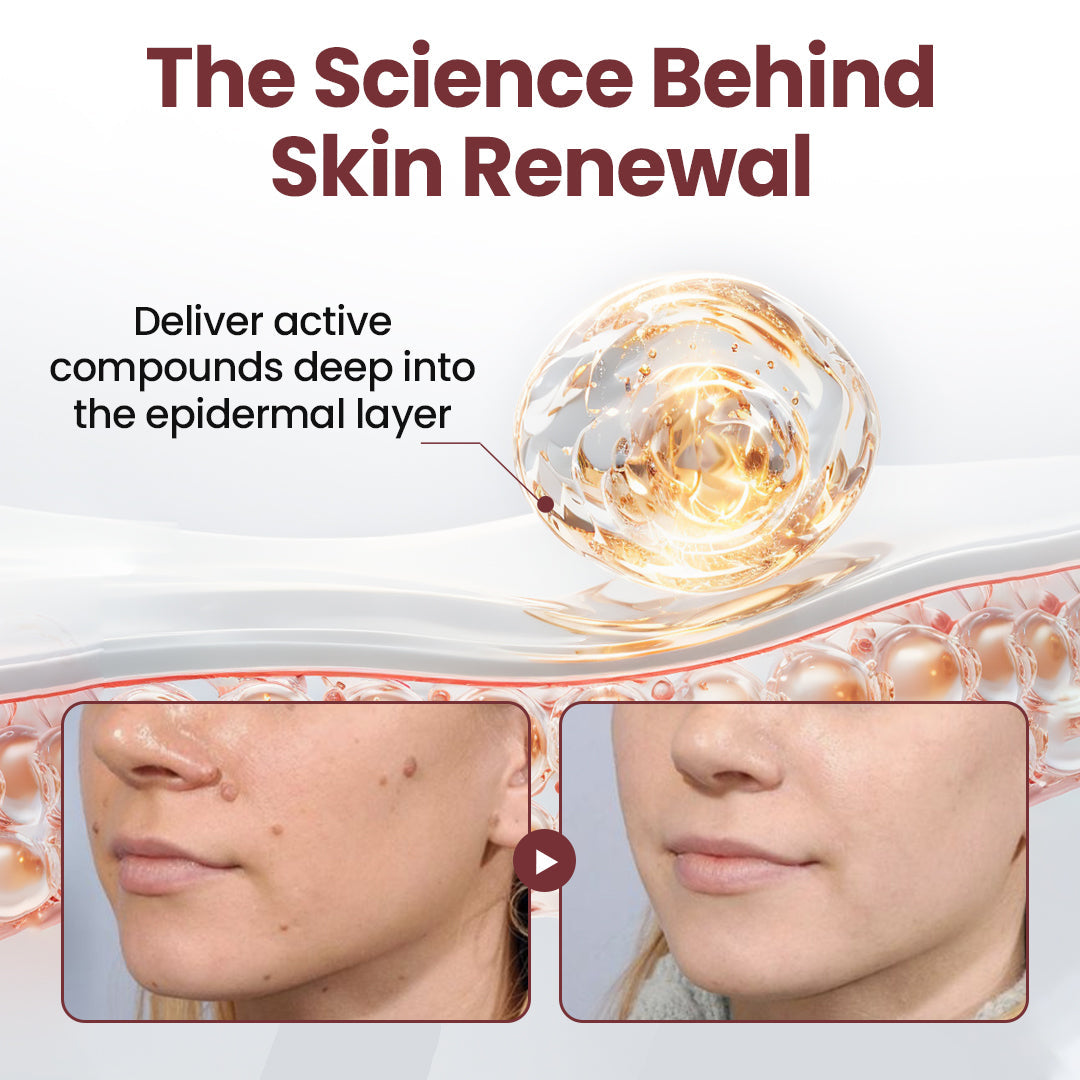 ✅Flash Sale -HEALRIZE®  KeraErase Dual-Action Renewal Cream
