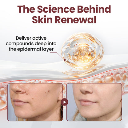 ✅Flash Sale -HEALRIZE®  KeraErase Dual-Action Renewal Cream