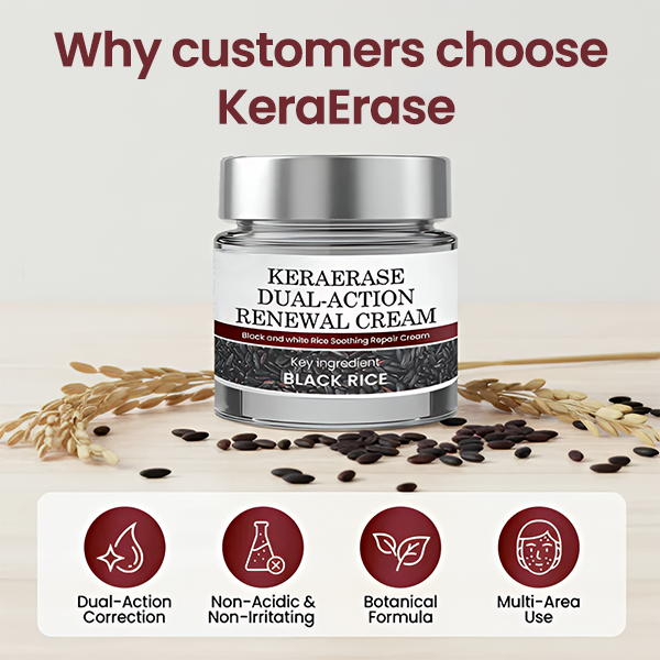 ✅Flash Sale -HEALRIZE®  KeraErase Dual-Action Renewal Cream