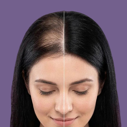 Rosemary Rice Water Volumizing Hair Spray